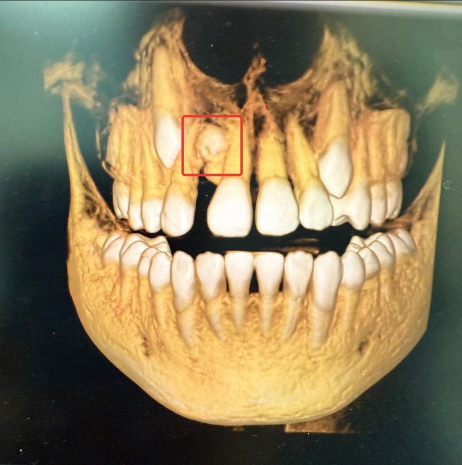 Клинический случай