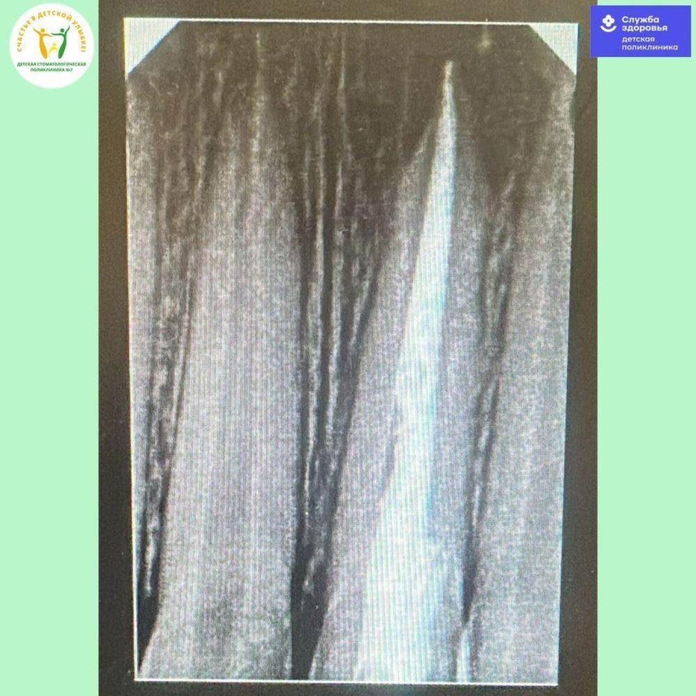 Клинический случай